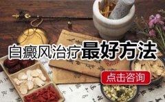 背部白癜风如何治疗